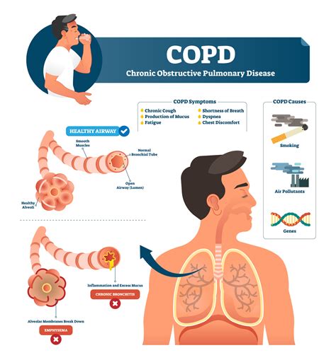 what does daliresp do for copd